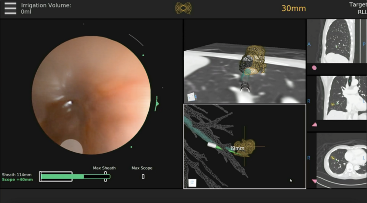 screening image