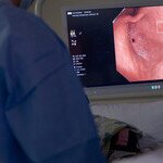 CU Medicine pioneers the introduction of a novel AI system for detection of early gastric cancers during upper GI endoscopy to increase the detection rate of the disease and facilitate endoscopists’ training 