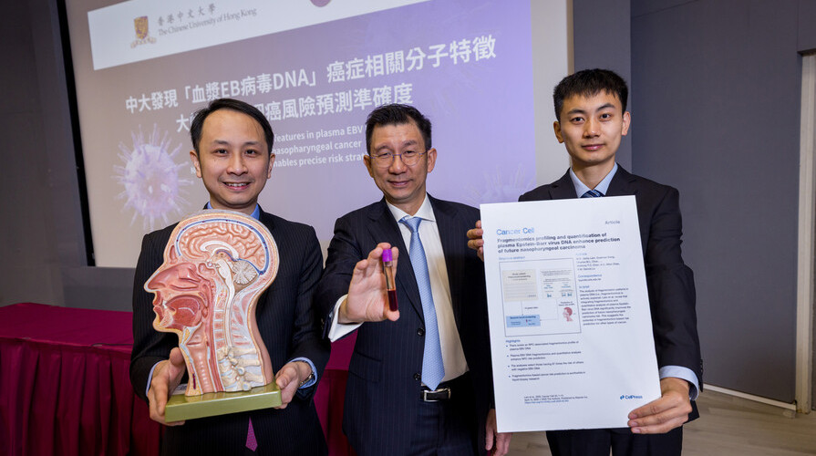 CUHK finds molecular features in plasma EBV DNA associated with nasopharyngeal cancer New screening strategy enables precise risk stratification