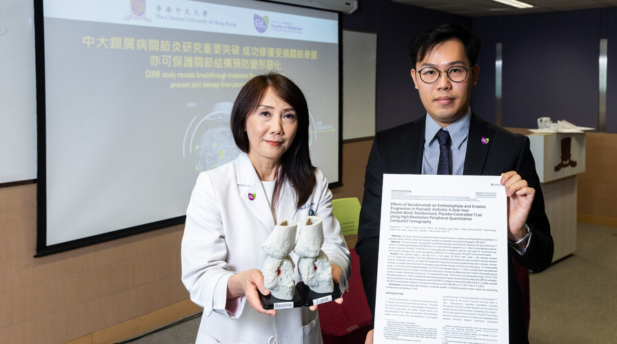 中大銀屑病關節炎研究重要突破 成功修復受損關節骨頭  亦可保護關節結構預防變形惡化
